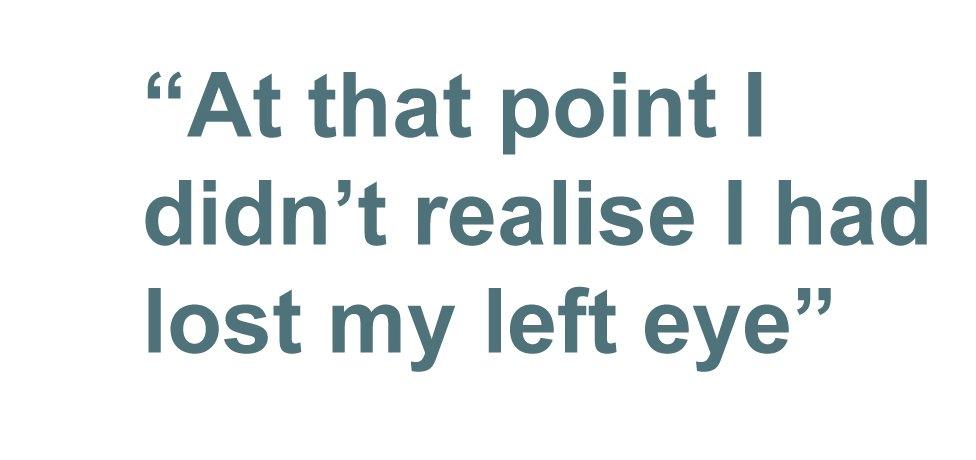 Quotebox: At that point I didn't realise I had lost my left eye