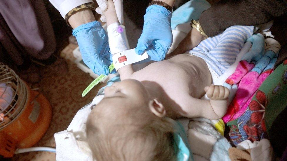 A baby is measured for malnutrition in Ghor