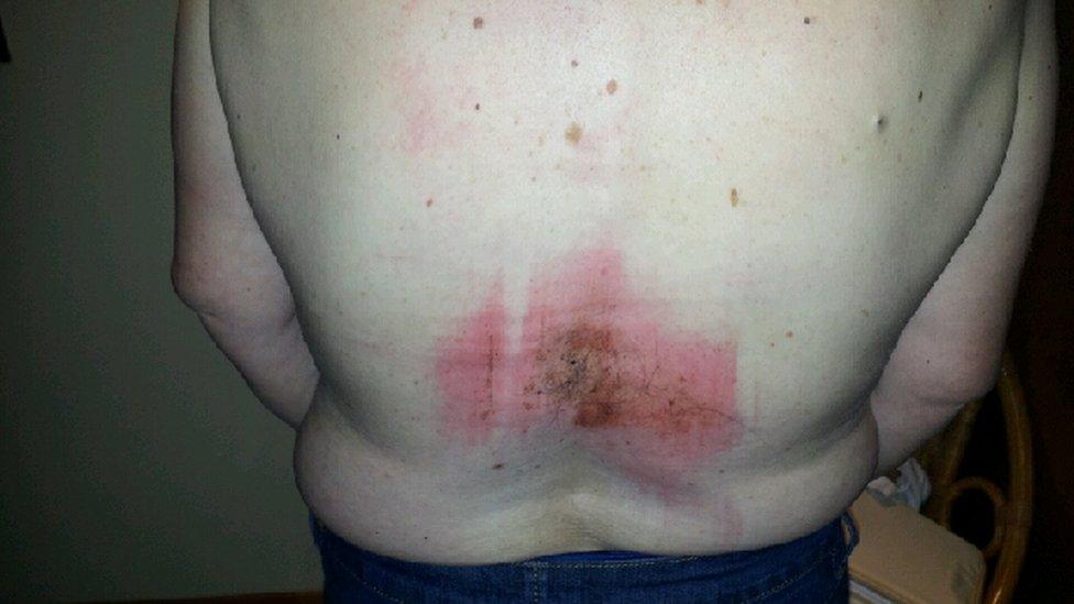 Mrs Shaw suffered injuries to her back