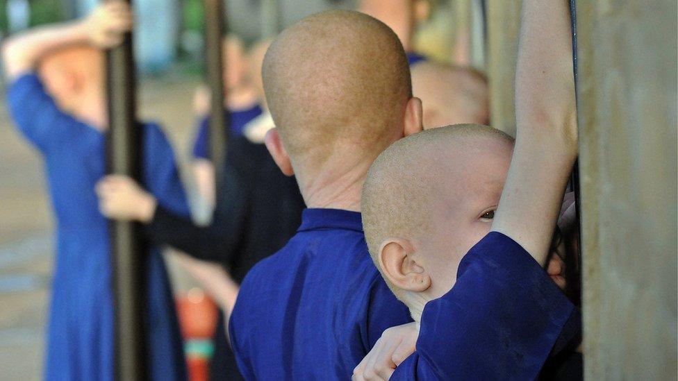 Albino children in Tanzania