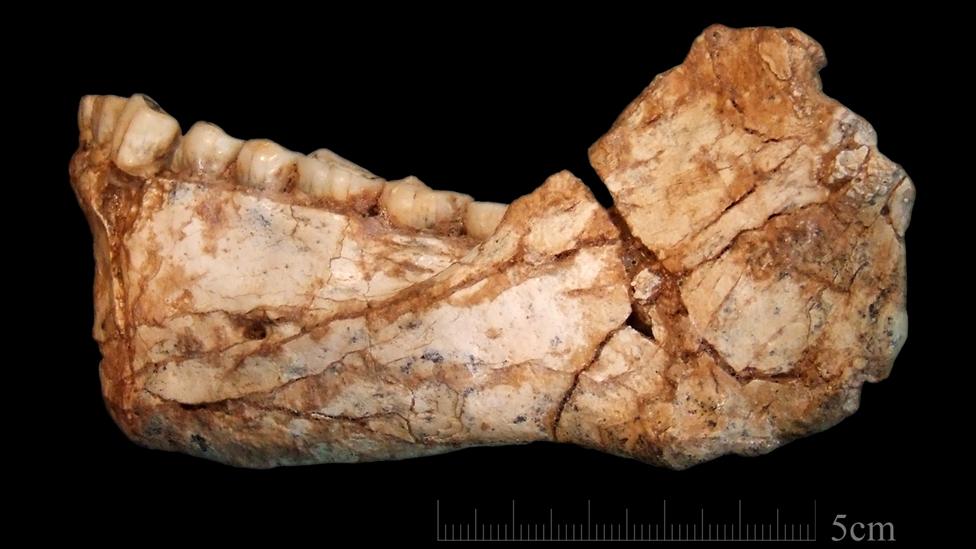 Lower jaw