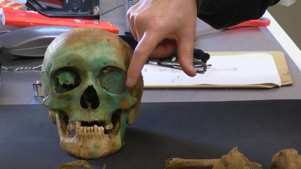 Skull exhumed from Hull's Trinity burial ground