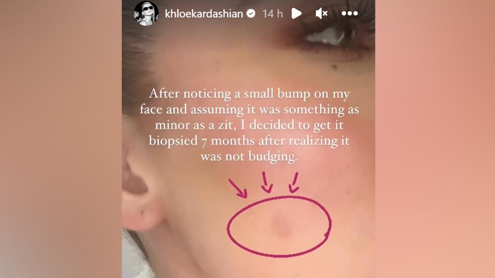 Screenshot of Khloe Kardashian's Instagram Story