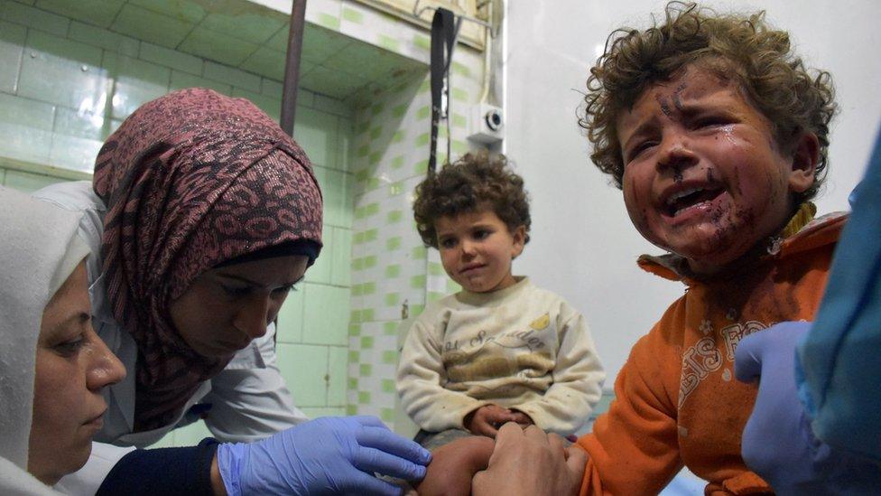 Syrian children, wounded in a suicide car bombing that targeted their buses in Rashidin, west of Aleppo, as they were being evacuated from two besieged government-held towns of Foah and Kafraya during an evacuation deal between the regime and rebels, receive treatment at a hospital in the government-held part of Aleppo on April 15, 2017