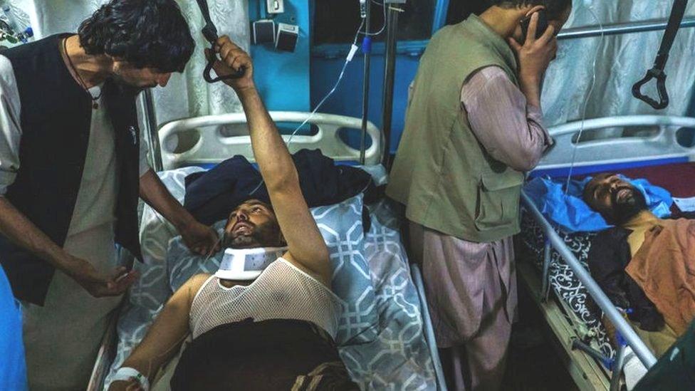 Kabul bombing survivor in hospital