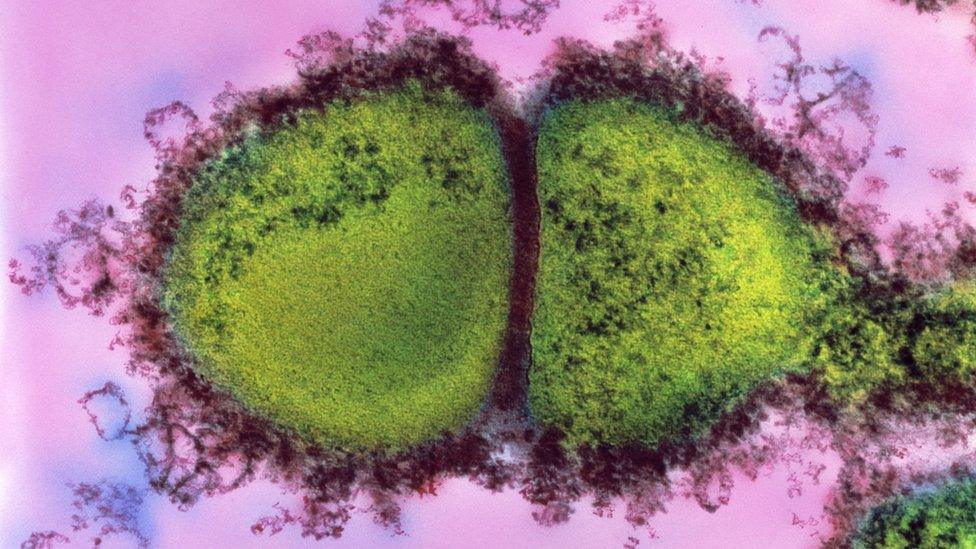 Streptococcus pyogenes bacteria