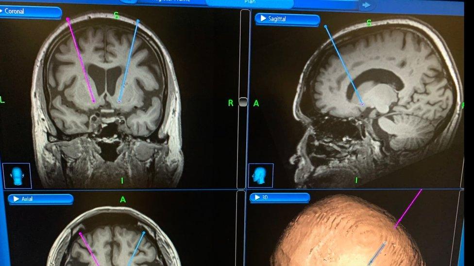 Scans of the human brain