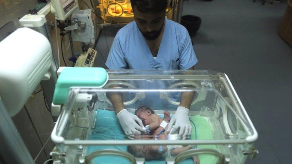 A medic with Palestinian conjoined twins as they lie in an incubator at the nursery of the Shifa Hospital in Gaza City (02 October 2017)