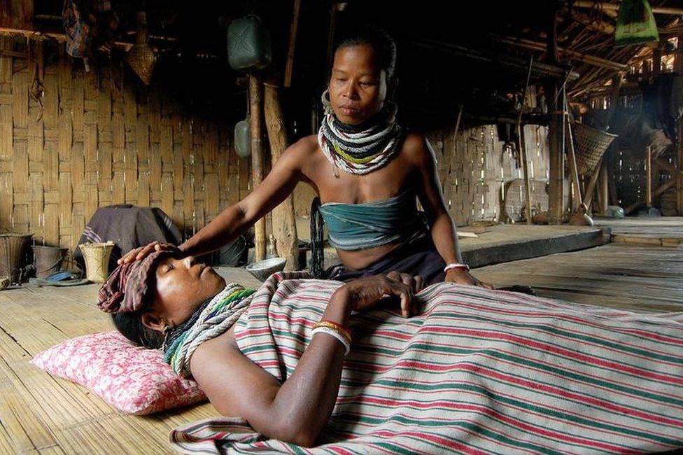 An Indian tribal woman attends a malaria infected woman at her home in the remote village of Bilaihum some 75 kms west of Agartala on May 2, 2008.