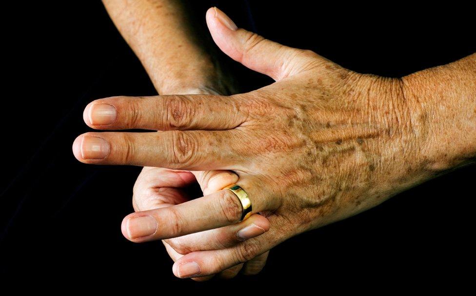 elderly person's hands, with wedding band being removed