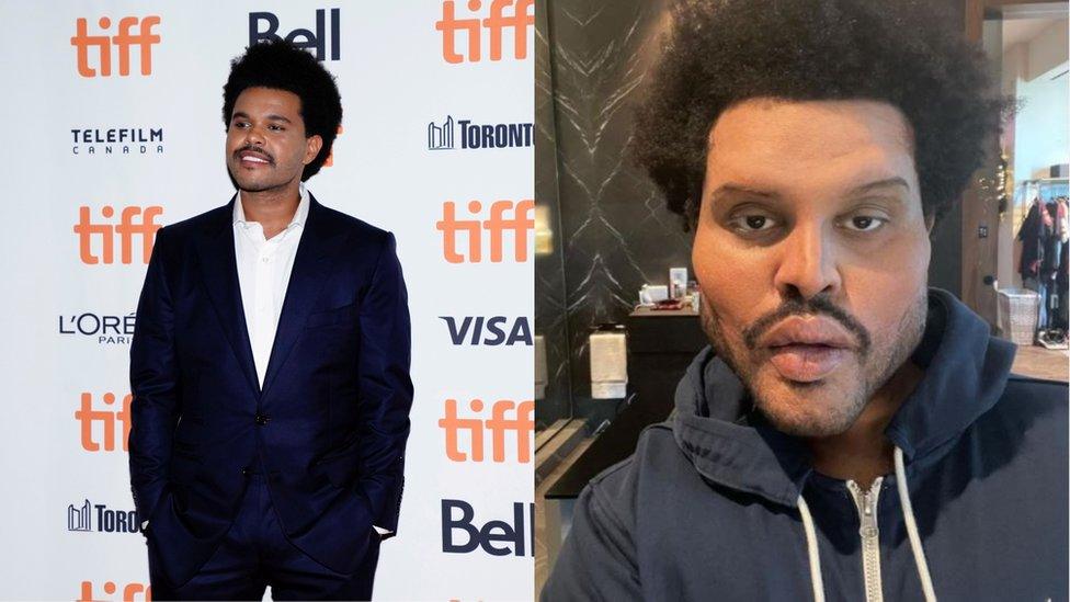 The Weeknd and the Weeknd in prosthetics