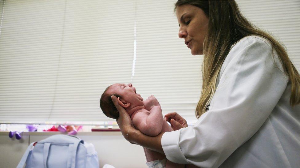 Dr. Vanessa Van Der Linden, examines a 2-month-old baby with microcephaly.