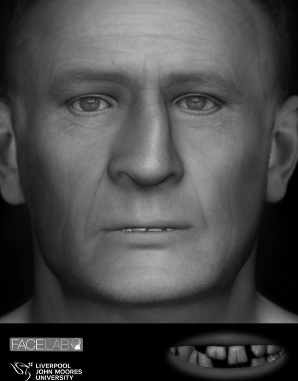 Facial reconstruction of man