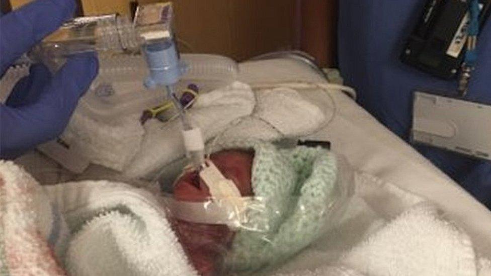 Lilly Rae was given intensive care