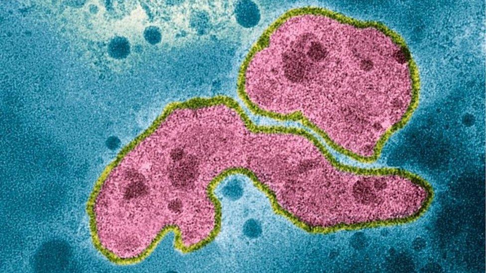 A coloured transmission electron micrograph of A strain H5N1