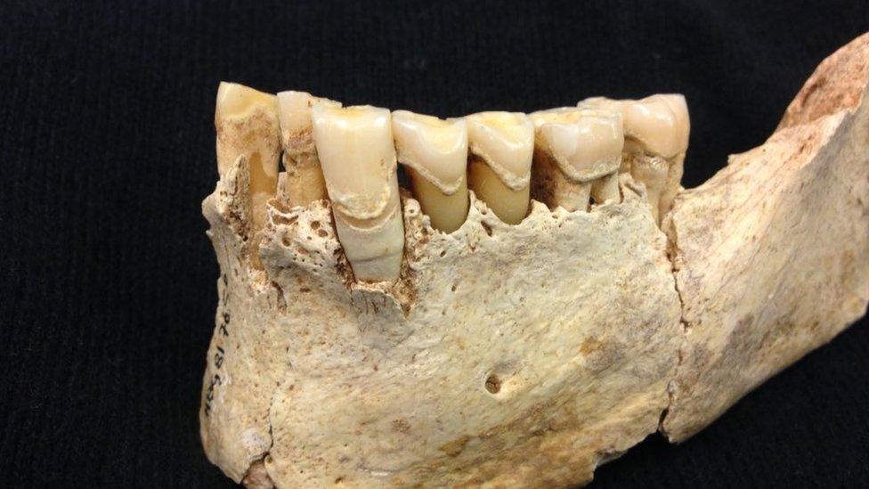 Neolithic jaw