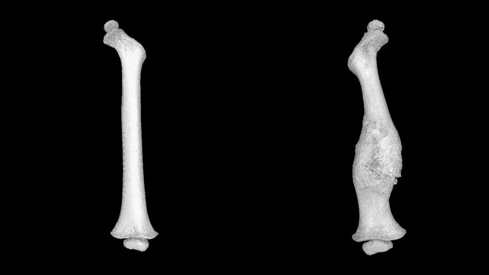 Left and right femur