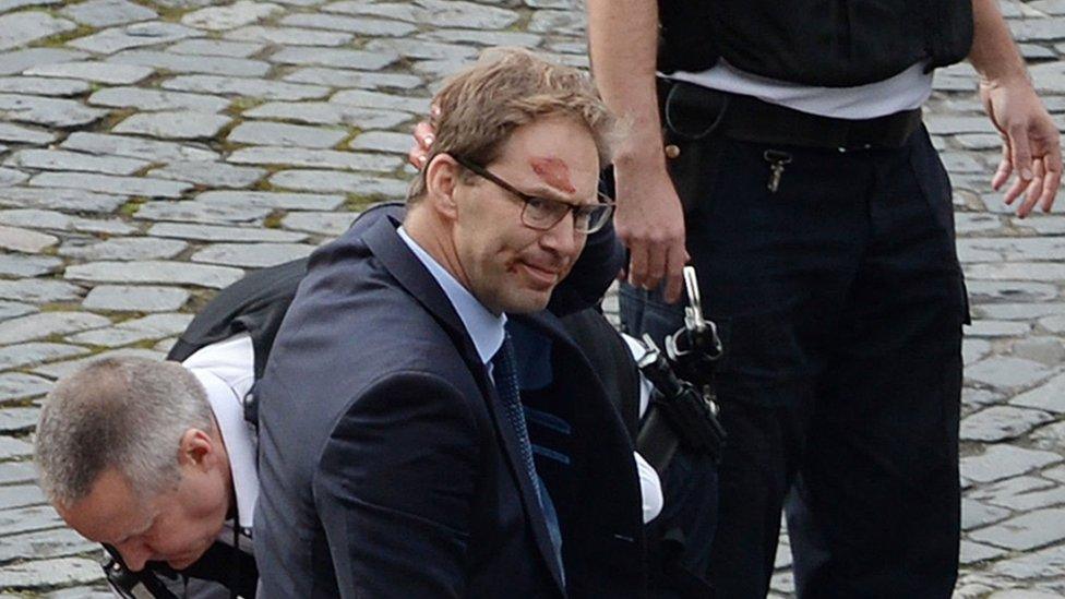 Tobias Ellwood with blood on his face after the attack