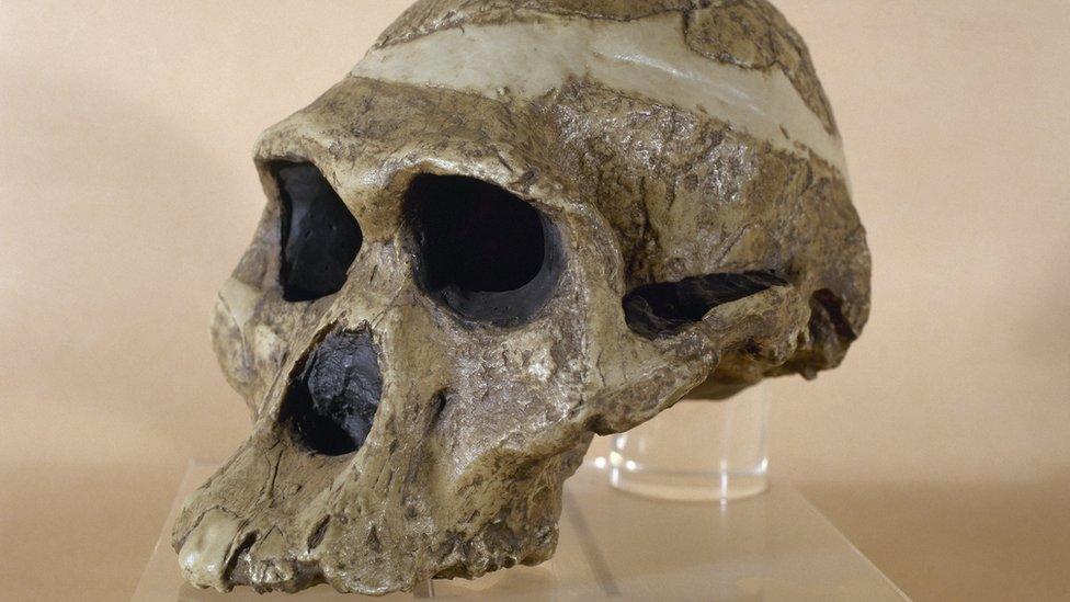 Image shows skull