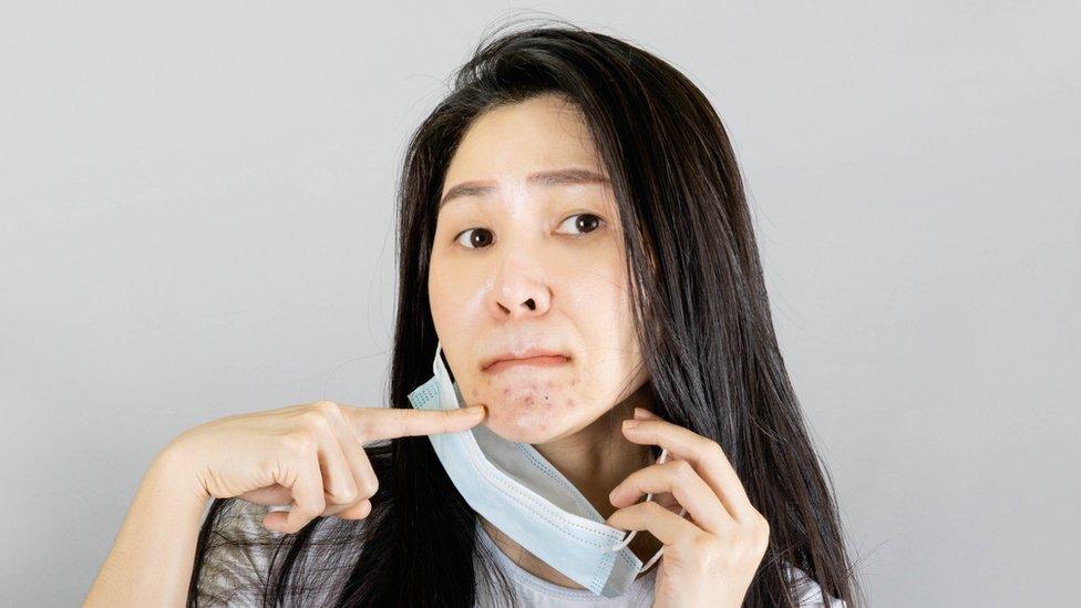 File photo of a young woman holding a face mask, pointing to spots on her chin