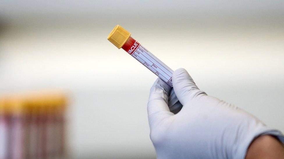 Blood sample being held in a gloved hand