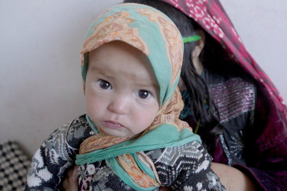 Baby on malnutrition ward in Ghor