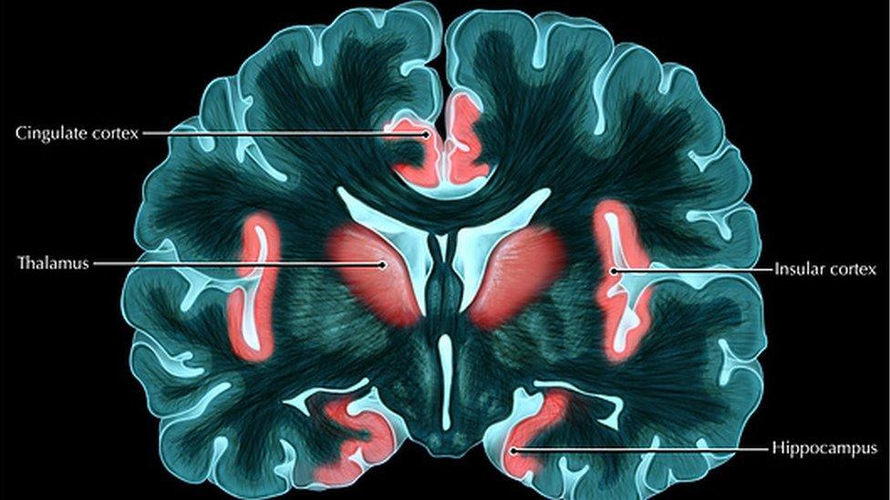 A cross-section map of the brain