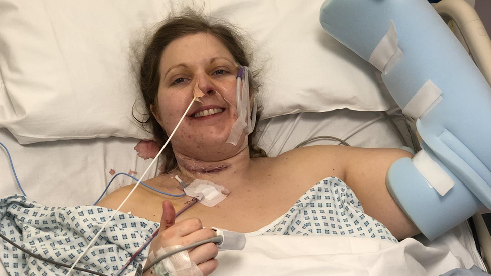 Barbara Fountain smiling in a hospital bed, with her left arm in a cast and tubes attached to her face and right hand, which is giving a thumbs up