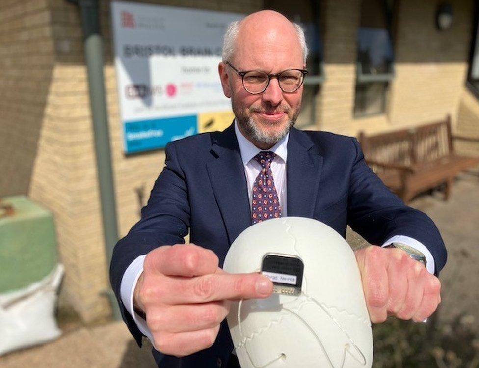 Dr Whone holding a skull showing where the implant will go in