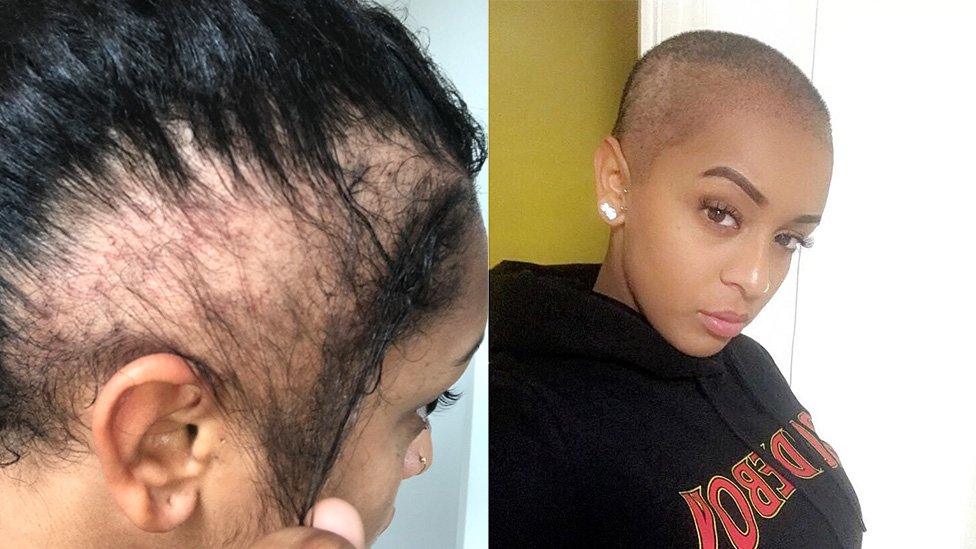 Paigey Cakey before her transplant and immediately after