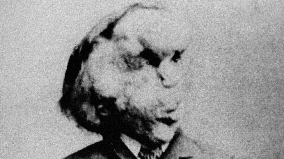 Joseph Merrick