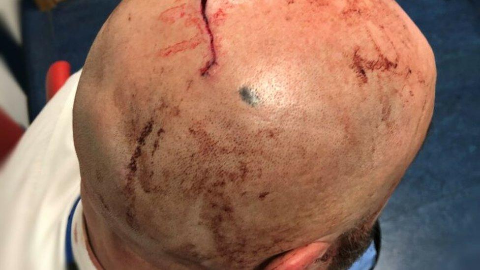 A picture of a prison officer who was attacked at HMP Bristol