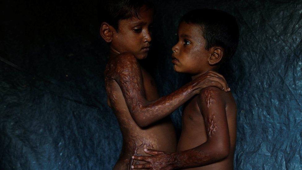 Mohamed Heron, 6, and his brother Mohamed Akter, 4