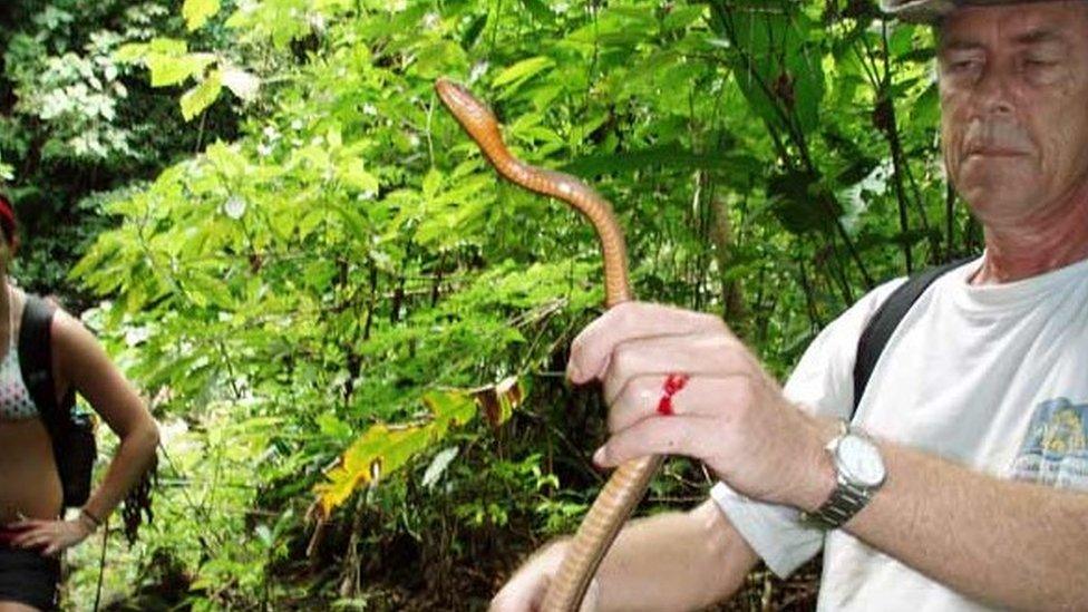 Mike pictured after he was bitten by a salmon-bellied racer