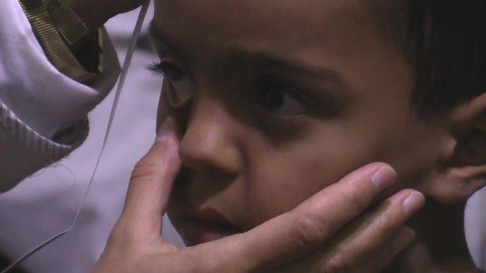 Boy is examined in makeshift clinic in Madaya