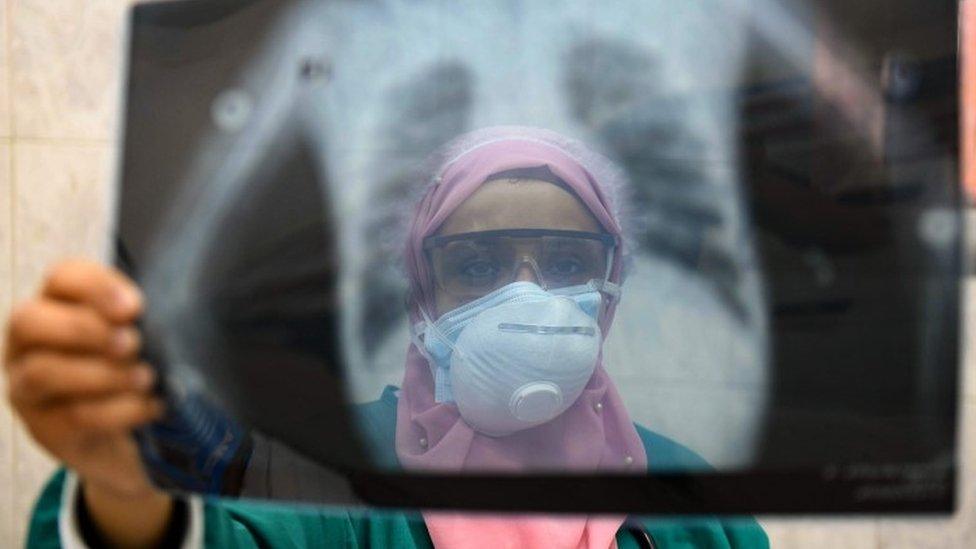 An Egyptian doctor looks at a chest x-ray at a hospital in Cairo (19 April 2020)