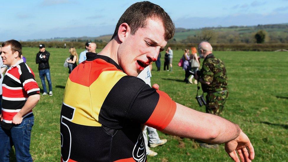 Injured man at bottle kicking