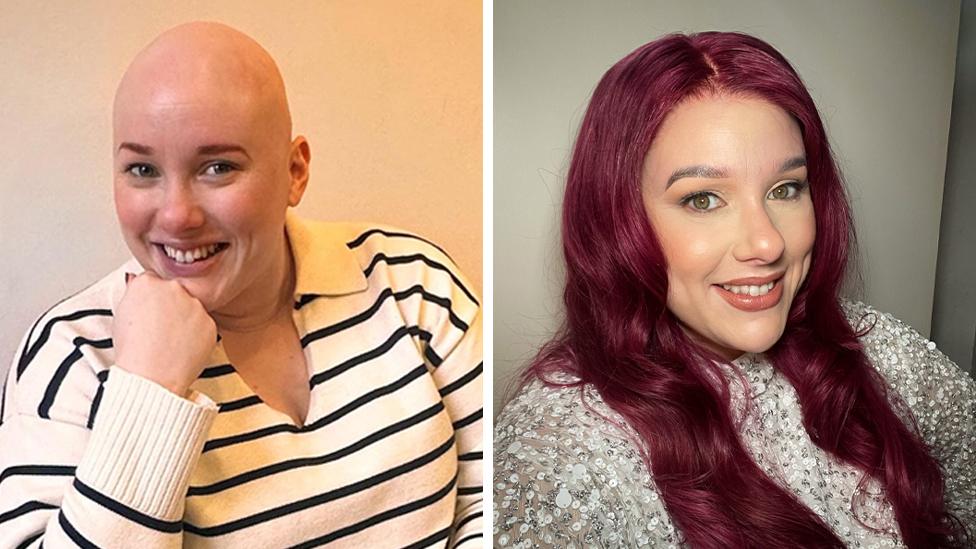 A woman with a bald head and a striped jumper smiles at the camera