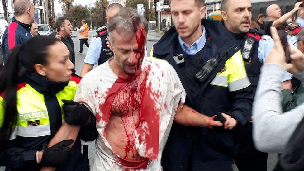 Eyewitness photo showing man with injury to his head and blood running down his face and body, ripped white T-shirt