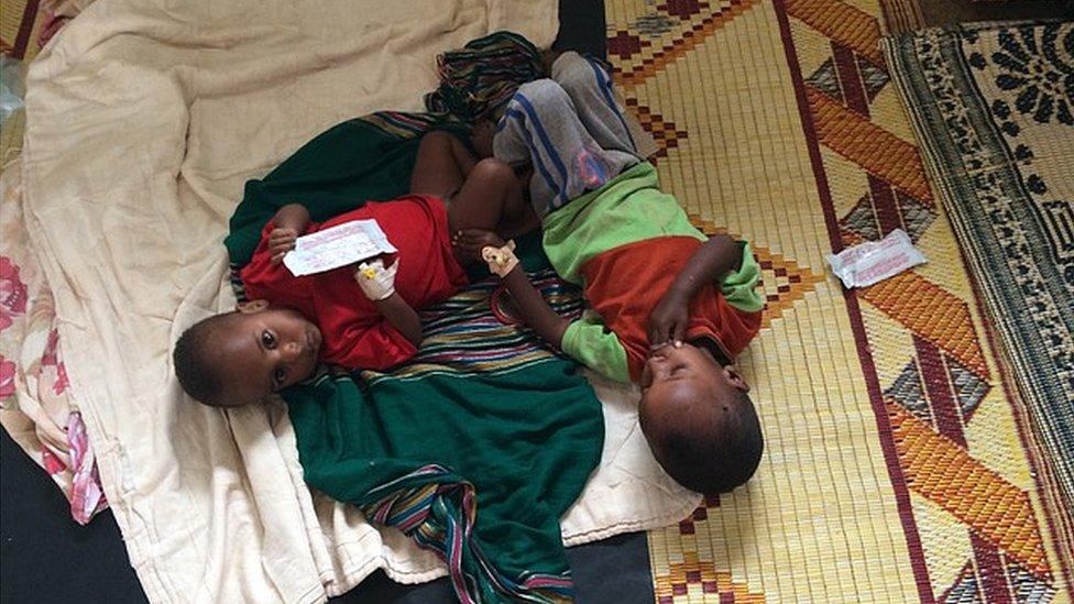 Two severely malnourished children in Baidoa regional hospital