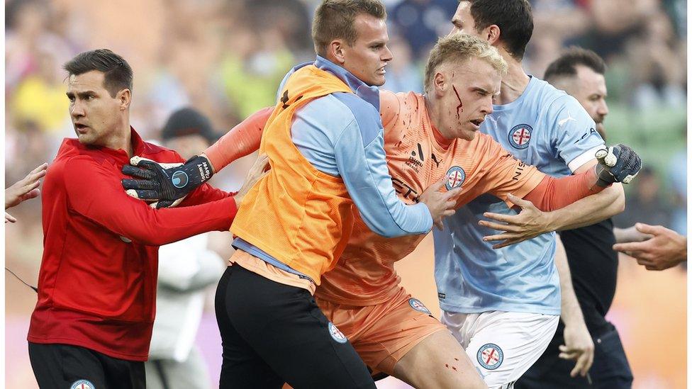 A bleeding Tom Glover of Melbourne City is escorted from the pitch.