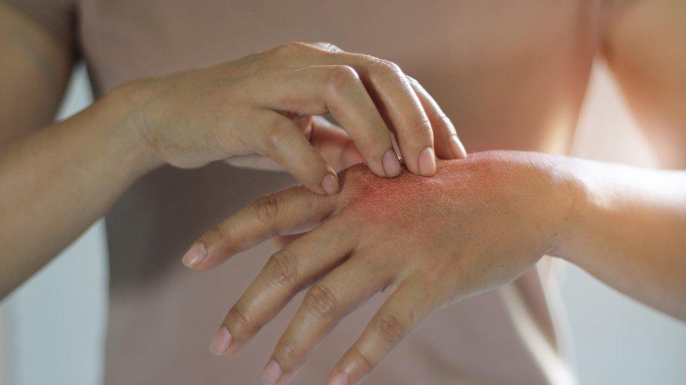 A woman scratching her skin