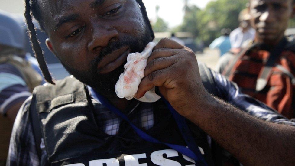 Photojournalist Dieu Nalio-Chery holds a gauze next to his mouth in Port-au-Prince, Haiti