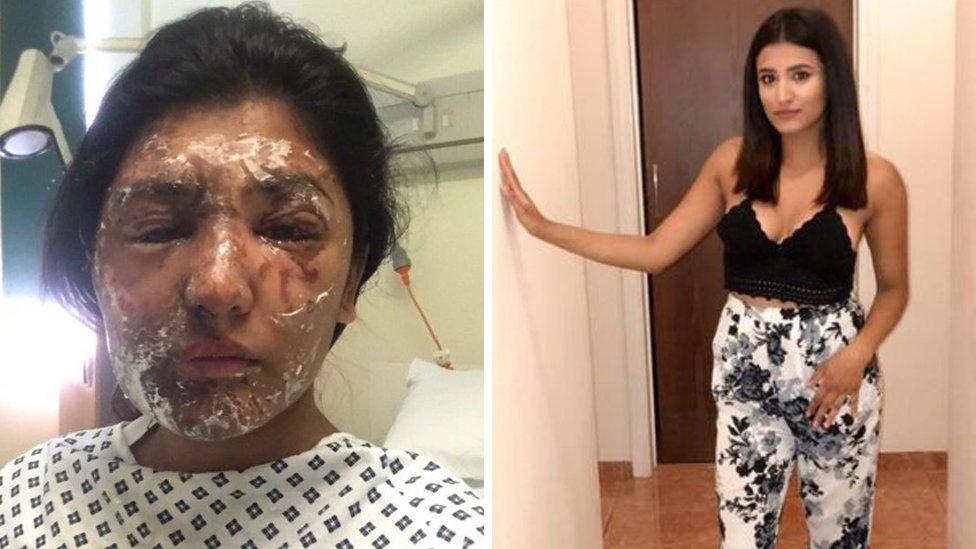 Resham Khan acid attack victim