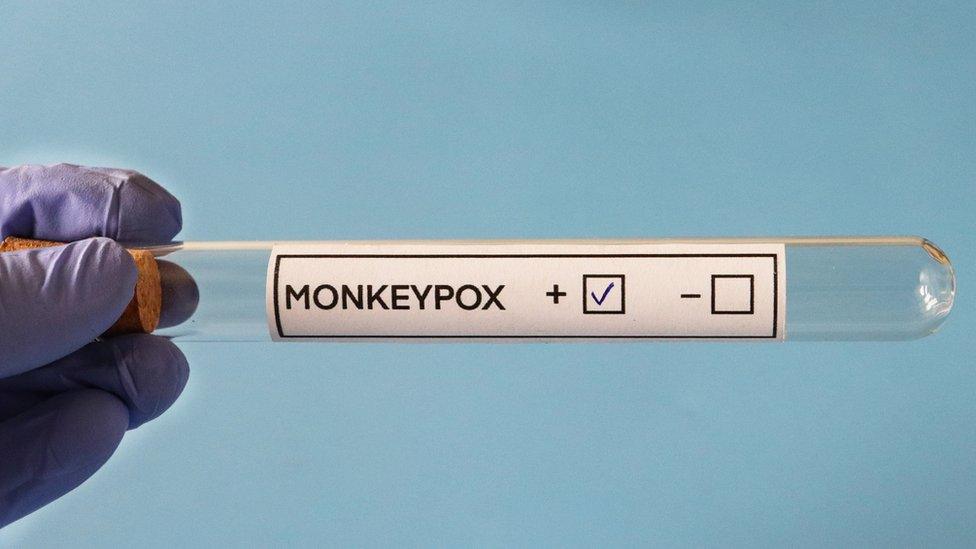 Test for monkeypox virus