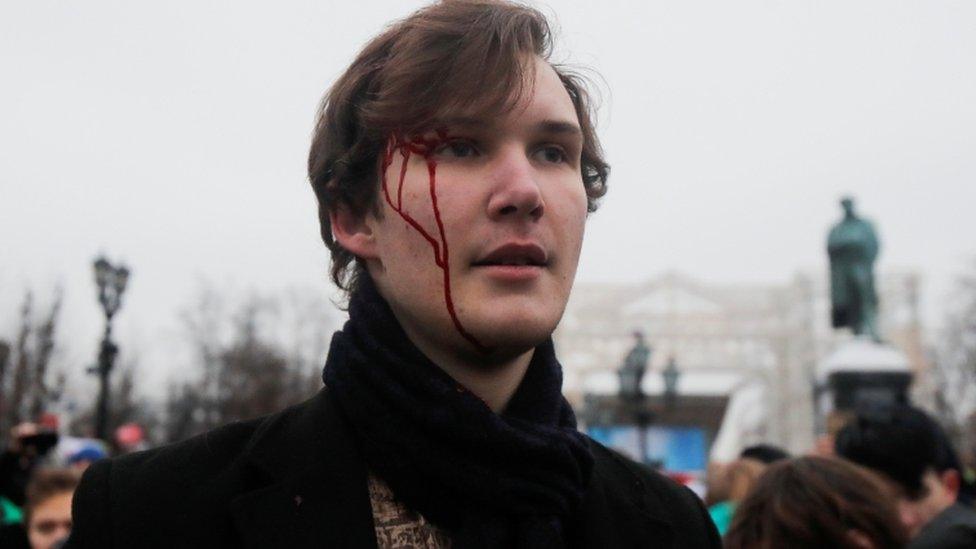 A pro-Nalavany protester is seen with blood on his head in Moscow protest