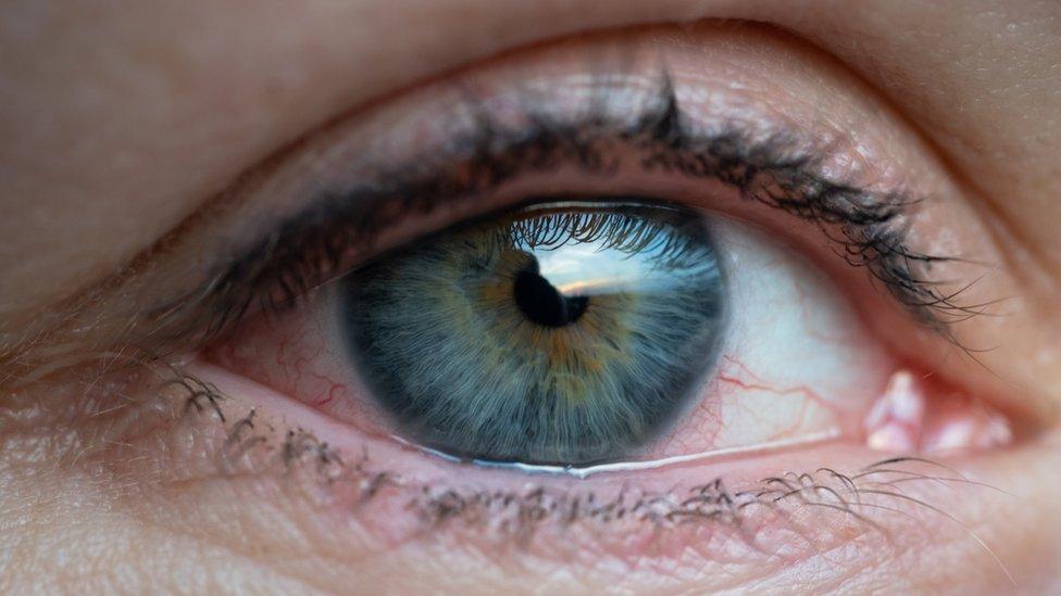 Eyeball