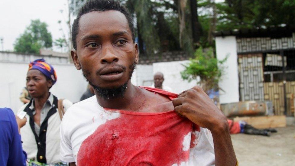 An injured Congolese opposition supporter walks outside the headquarters of the Union for Democracy and Social Progress (UDPS) during violent protests to press President Joseph Kabila to step down, in the Democratic Republic of Congo's capital Kinshasa, September 20