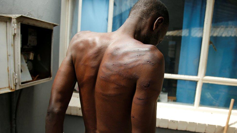 An arrested injured man is seen at a hospital following protests in Harare, Zimbabwe, 16 January 2019