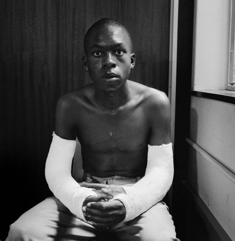 Fifteen-year old Lawrence Matjee after his assault and detention by the Security Police, Khotso House, de Villiers Street, Soweto, Johannesburg, 1985.